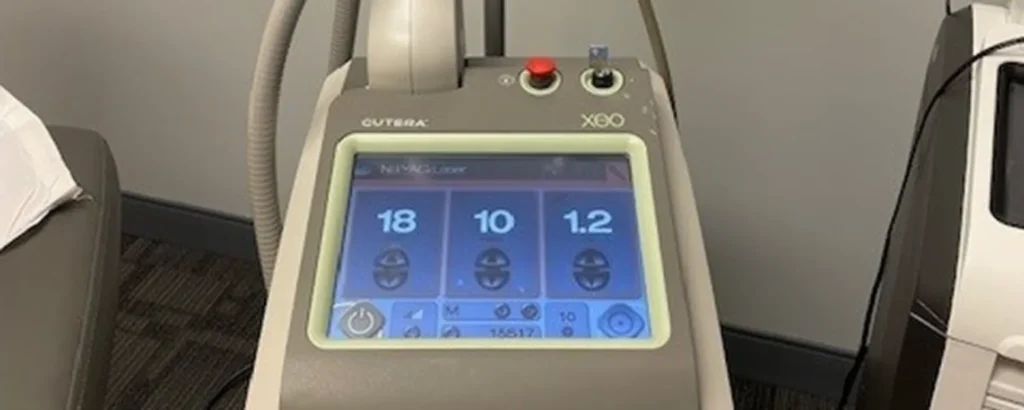 Laser Skin Treatments